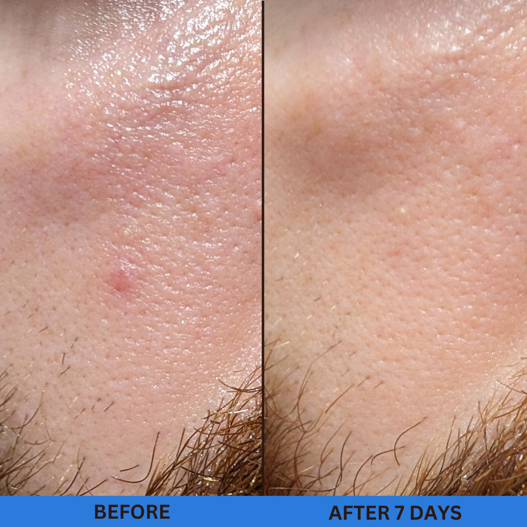 before and after redness, congestion and dehydration
